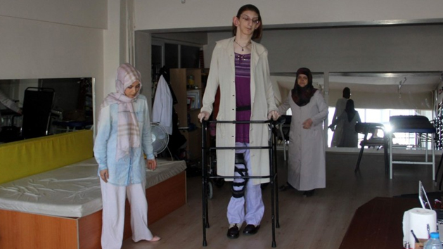 Rumeysa Gelgi la chica más alta del mundo