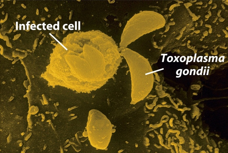 toxoplasmosis-cell