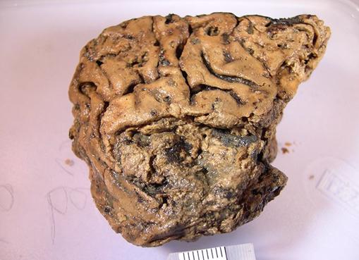 El cerebro que sobrevivió 2600 años en el barro. Sorprendente.