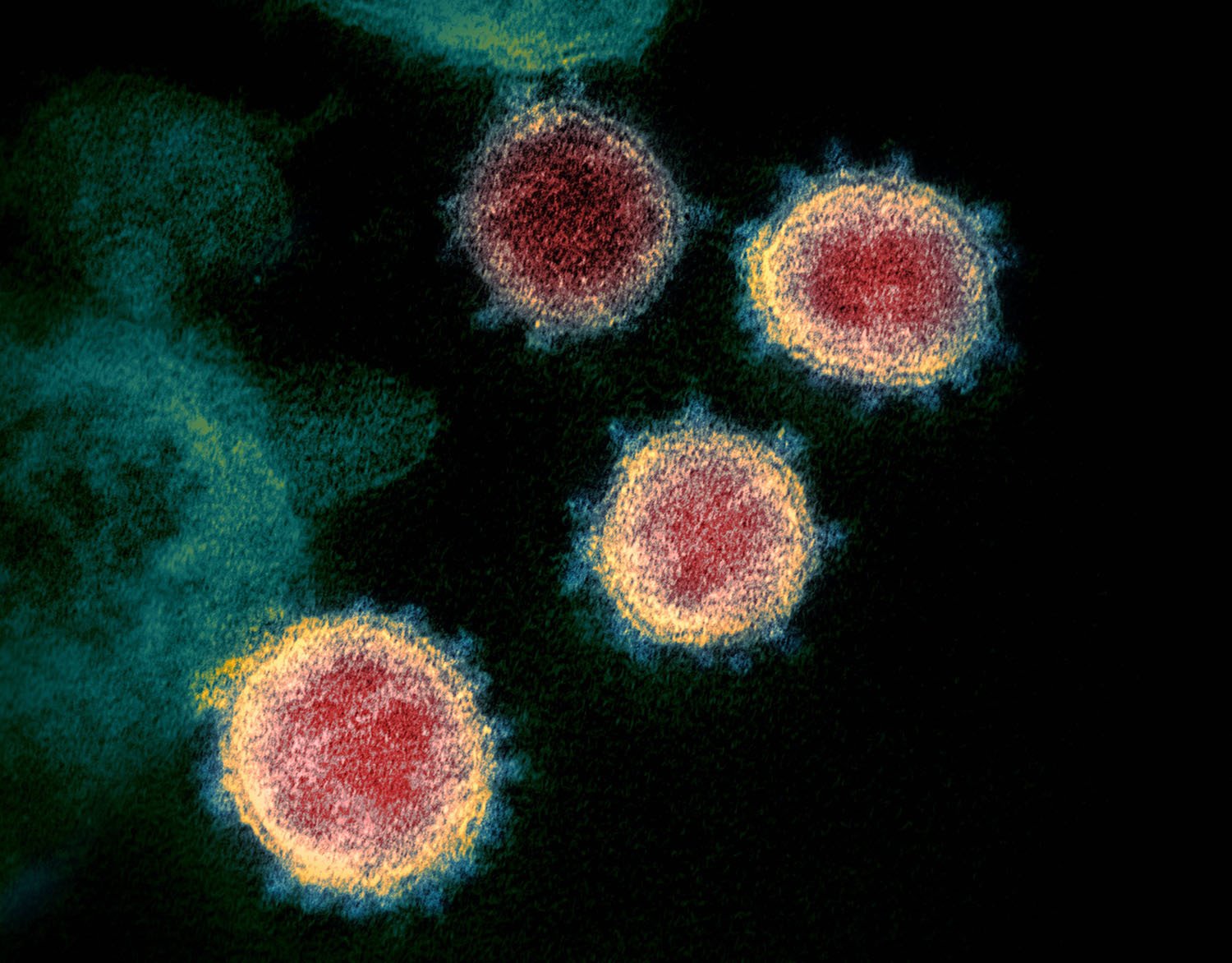 La humanidad sigue buscando respuestas para enfrentar el virus que aquí aparece en a foto, el SARS-CoV-2
