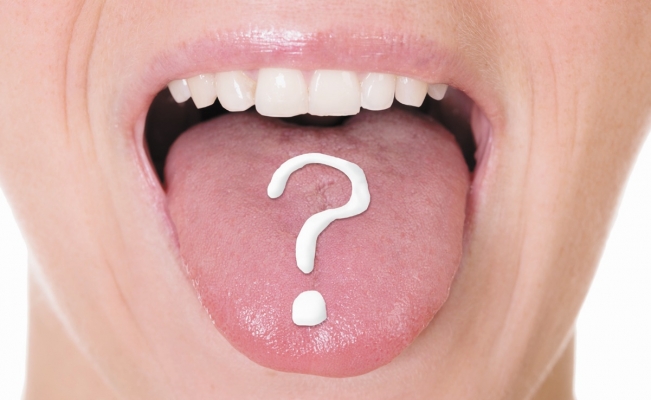 Los microbios de la lengua son más numerosos de lo que imaginas.