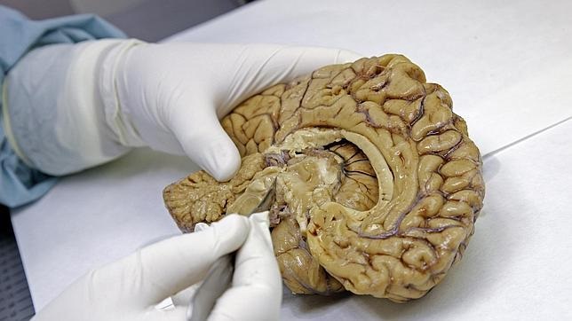 Este estudio ayudaría a los estudios post mortem que se hagan de tejidos del cerebro.