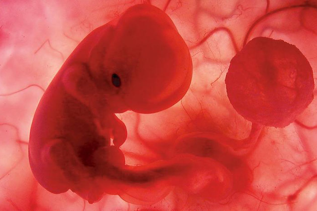 Un modelo de embrión humano generado con células de piel, por primera vez.