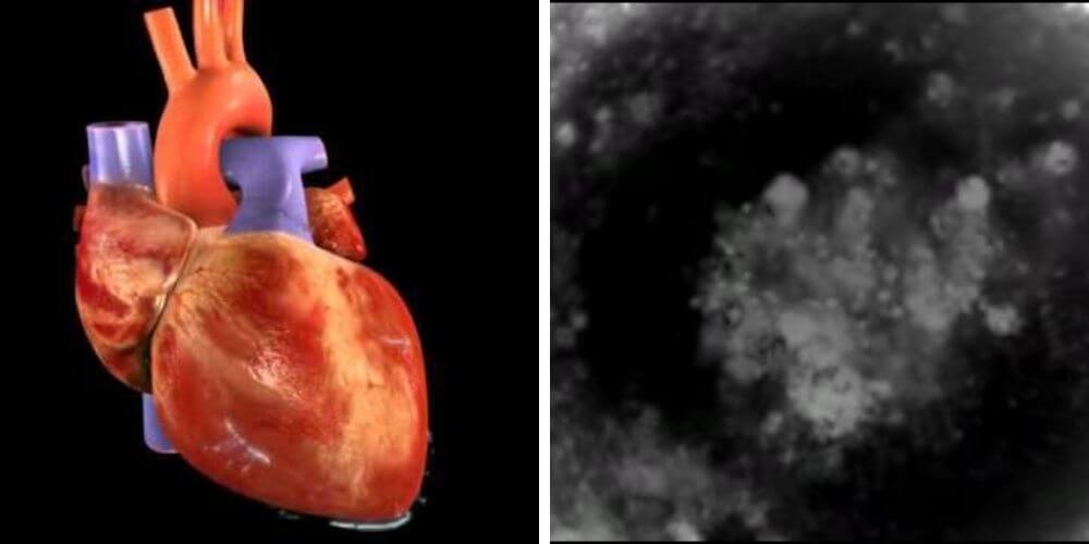 El corazón de células madre que palpita es otra hazaña científica.