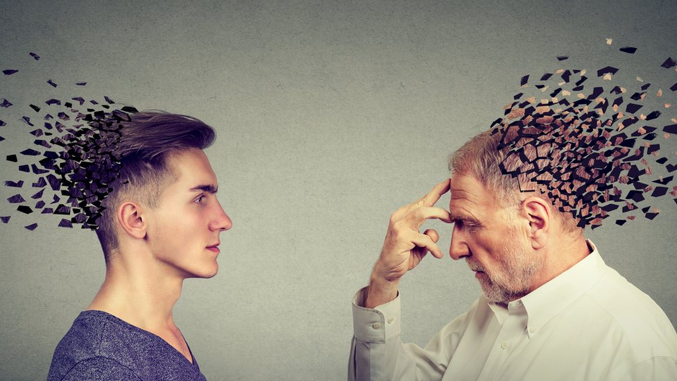 El raro caso de Alzheimer adolescente se presentó en una persona desde los 17 años.