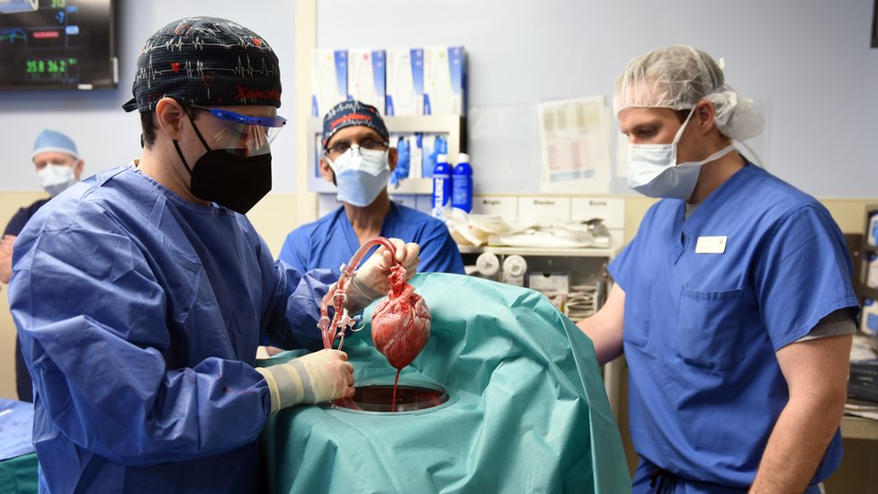 La técnica para resucitar órganos, PRN, puede salvar muchas vidas.