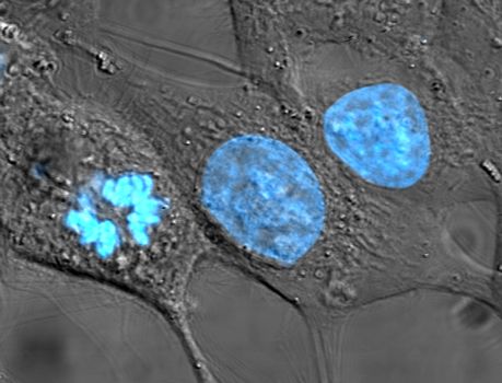 células HeLa de Henrietta Lacks