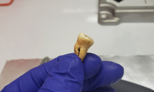 El análisis de los dientes resultó clave.