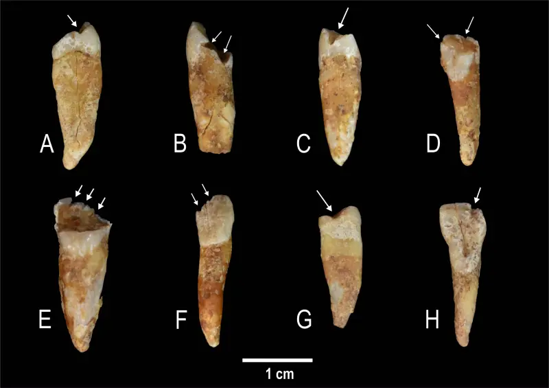 Los dientes de las mujeres textileras hablan de identidades de género.