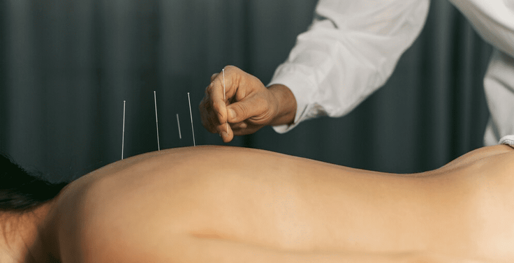 Es una técnica muy extendida en el país asiático
