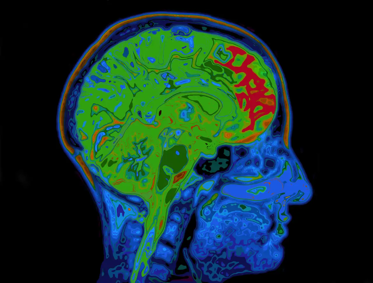 La terapia china que modifica el cerebro es la acupuntura.