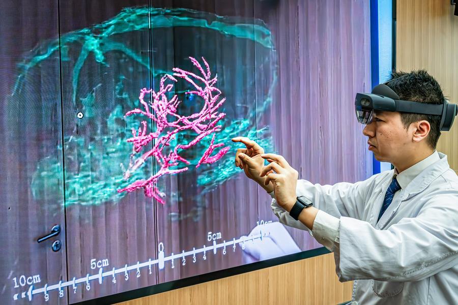 La primera interfaz neuronal del oído es un importante logro de la medicina.
